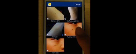 Mobile Melanoma Analyser