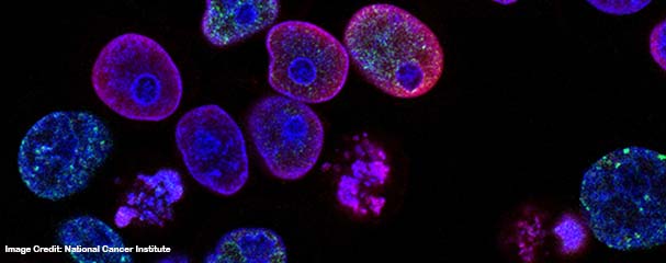 SUTD researchers develop low-cost electroporation device that could expand global access to cancer drugs