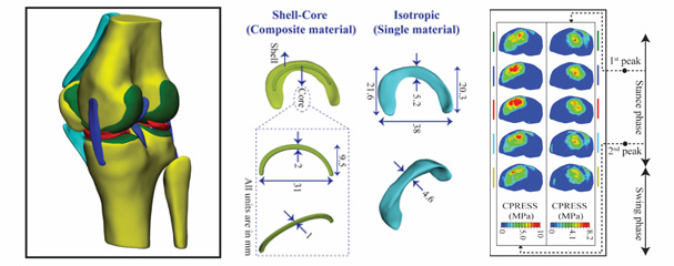 SUTD-led research sets the groundwork for patient-specific 3D printed meniscus