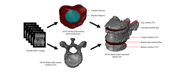 SUTD and collaborators developed novel methodology to predict spinal fractures in patients